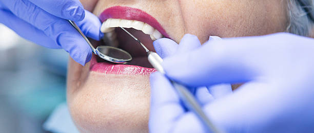 Best Emergency Gum Treatment in New Brighton, MN